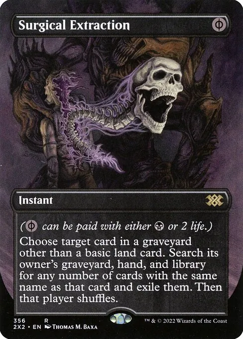 Surgical Extraction 356/331
